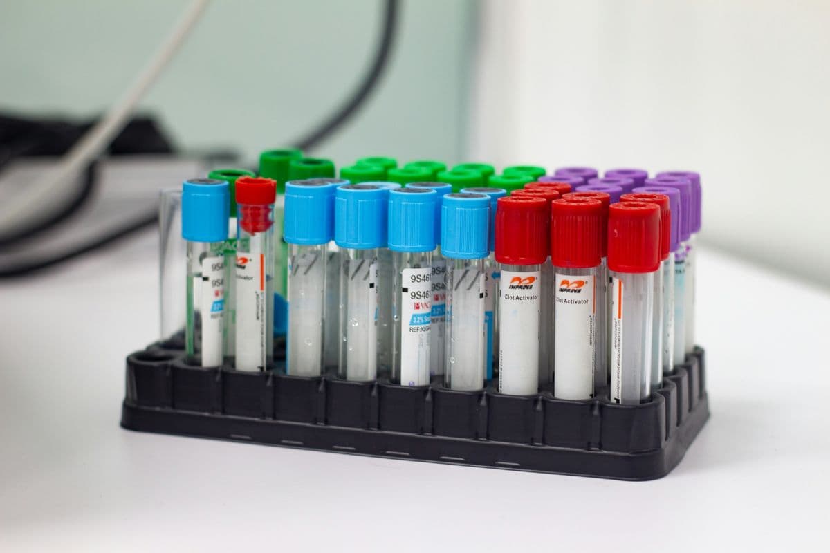 Rack of colorful-capped clinical sample tubes on a white laboratory bench